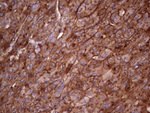APOE Antibody in Immunohistochemistry (Paraffin) (IHC (P))