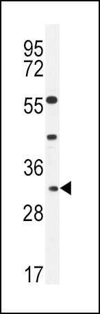 Apolipoprotein F Antibody in Western Blot (WB)