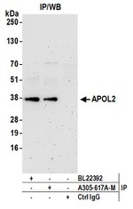 APOL2 Antibody in Western Blot (WB)
