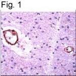 beta Amyloid Antibody in Immunohistochemistry (IHC)