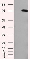 APP Antibody in Western Blot (WB)