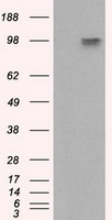 APP Antibody in Western Blot (WB)
