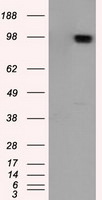 APP Antibody in Western Blot (WB)