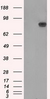 APP Antibody in Western Blot (WB)