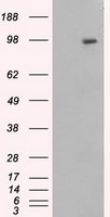 APP Antibody in Western Blot (WB)