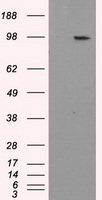 APP Antibody in Western Blot (WB)