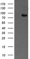 APP Antibody in Western Blot (WB)