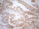APPL1 Antibody in Immunohistochemistry (Paraffin) (IHC (P))