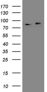 APPL1 Antibody in Western Blot (WB)