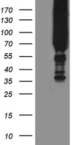 APPL2 Antibody in Western Blot (WB)