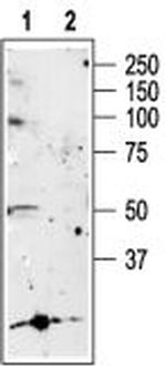 P2X5 Receptor Antibody in Western Blot (WB)