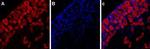 P2X3 Receptor Polyclonal Antibody, Atto™ 594