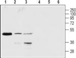 P2Y1 Receptor (extracellular) Antibody in Western Blot (WB)