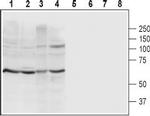P2X4 Receptor (extracellular) Antibody in Western Blot (WB)