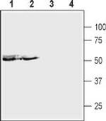 P2X5 Receptor (extracellular) Polyclonal Antibody