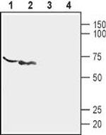 P2X6 Receptor (extracellular) Polyclonal Antibody