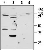 PAR2 (F2RL1) Antibody in Western Blot (WB)