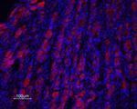 Prokineticin Receptor 2 (extracellular) Polyclonal Antibody