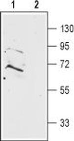 Prokineticin Receptor 2 (extracellular) Antibody in Western Blot (WB)