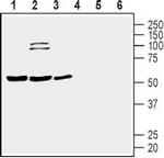 Prostacyclin Receptor (PTGIR) (extracellular) Polyclonal Antibody
