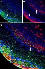 Plexin-A1 (extracellular) Antibody in Multiplex Immunohistochemistry (mIHC)
