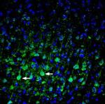 Plexin-A3 (extracellular) Polyclonal Antibody