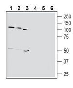Thromboxane A2 Receptor (extracellular) Polyclonal Antibody