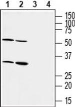 P2Y6 Receptor (extracellular) Antibody in Western Blot (WB)