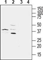 P2Y6 Receptor (extracellular) Antibody in Western Blot (WB)