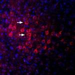 PSD-95 Polyclonal Antibody