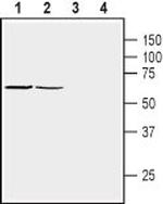 beta 1-Syntrophin (SNTB1) Antibody in Western Blot (WB)