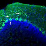 AKAP12 Polyclonal Antibody