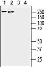 AKAP12 Antibody in Western Blot (WB)