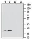 Alpha-Synuclein Antibody in Western Blot (WB)