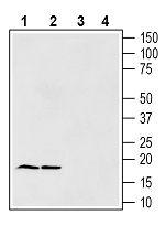Gamma-Synuclein Antibody in Western Blot (WB)