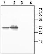 Aquaporin 5 Antibody in Western Blot (WB)
