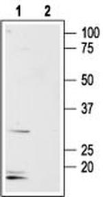 Aquaporin 8 Antibody in Western Blot (WB)