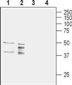 Aquaporin 11 (extracellular) Polyclonal Antibody