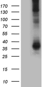AQP8 Antibody in Western Blot (WB)