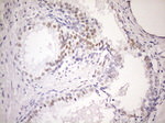 AR Antibody in Immunohistochemistry (Paraffin) (IHC (P))