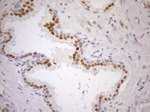 AR Antibody in Immunohistochemistry (Paraffin) (IHC (P))