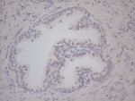 AR Antibody in Immunohistochemistry (Paraffin) (IHC (P))