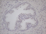 AR Antibody in Immunohistochemistry (Paraffin) (IHC (P))