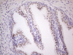 AR Antibody in Immunohistochemistry (Paraffin) (IHC (P))