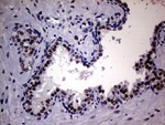 AR Antibody in Immunohistochemistry (Paraffin) (IHC (P))