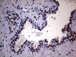 AR Antibody in Immunohistochemistry (Paraffin) (IHC (P))