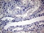 AR Antibody in Immunohistochemistry (Paraffin) (IHC (P))