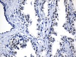 AR Antibody in Immunohistochemistry (Paraffin) (IHC (P))