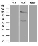 AR Antibody in Western Blot (WB)