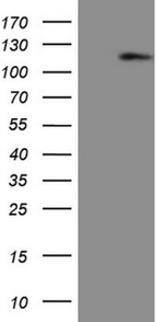 AR Antibody in Western Blot (WB)